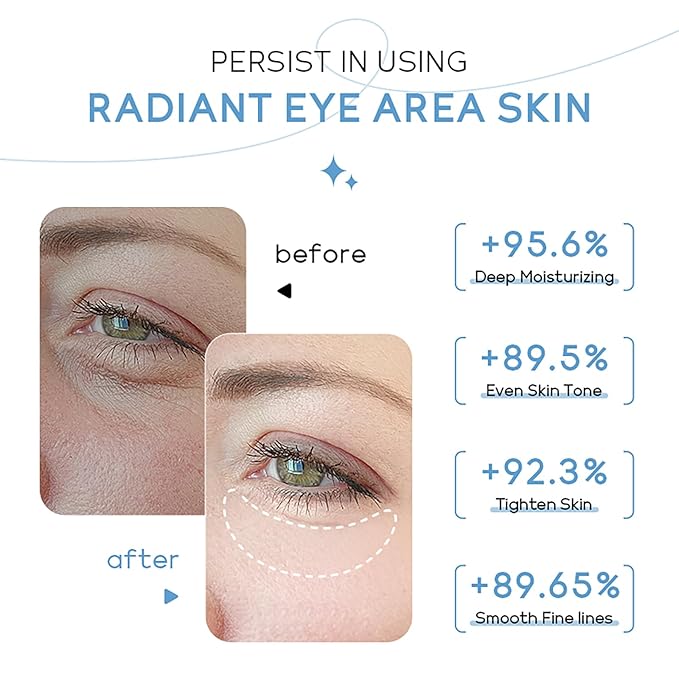 ARAKY Milk Under Eye Cream Roll-On, Triple Roll & Glow the Skin Around The Eyes, Eye Serum For Dullness, Dryness, Fine Lines, Repair Wrinkles Under The Eyes, Intense Hydrating Eye Treatment Serum Oil