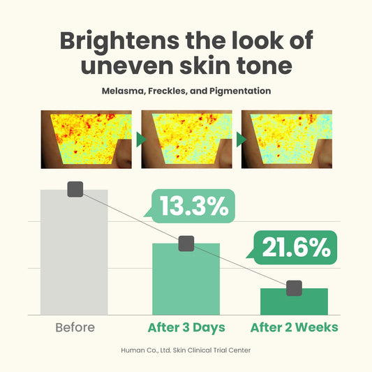 AXIS-Y Dark Spot Correcting Glow Serum - 5% Niacinamide Dark Spot Remover For Face - Vegan Korean Skin Care Niacinamide Serum for All Skin Types - 1.69 fl. oz.