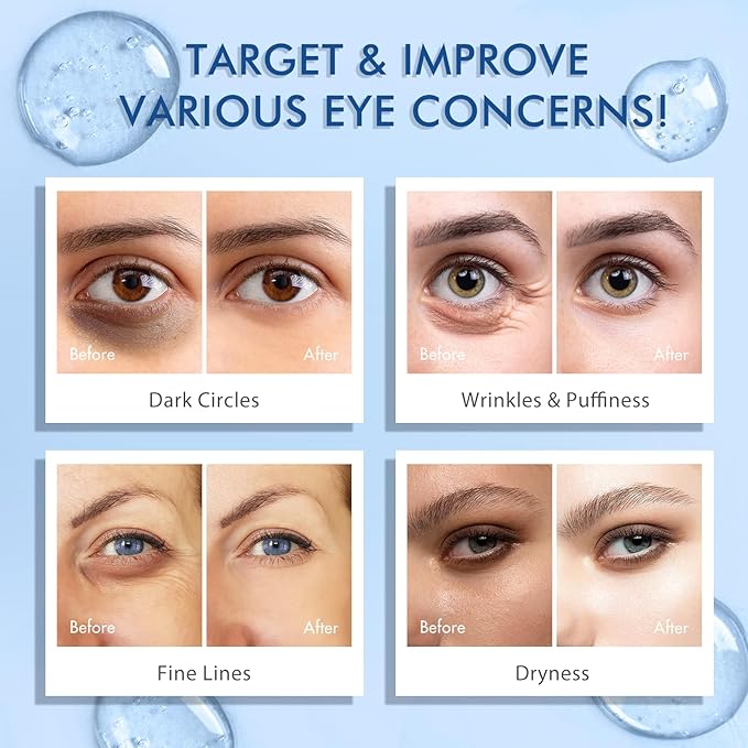 5% Caffeine Eye Cream for Dark Circles and Puffiness, Under Eye Serum for Wrinkles, Eye Serum for Under Eye Bags Fine Lines with 360° Eye Massage Ball, Morning Night Eye Skin Care for Men and Women