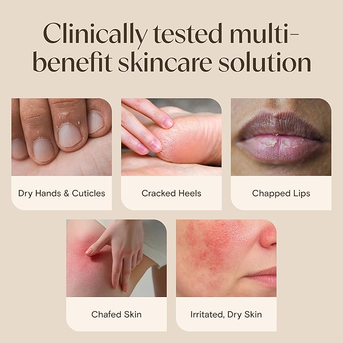 Aveeno Skin Relief Healing Ointment, Repair & Protect Extra Dry, Cracked Skin, Glycerin Protectant with Triple Oat & Shea Butter, Fragrance-Free & Non-Greasy Feel, Travel Size, 2.0 oz (Pack of 3)