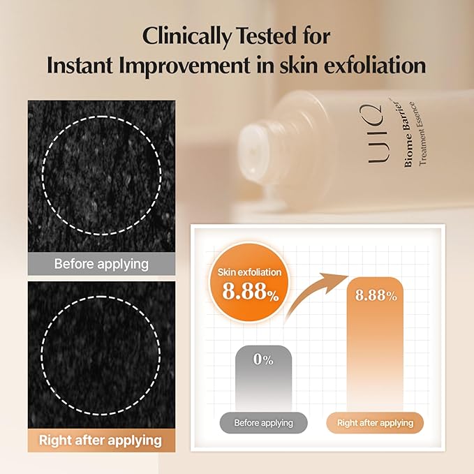 UIQ Biome Barrier Treatment Essence Nourishing, Hydrating, Moisturizing Toner l Korean Skincare for All Skin Types | Daily Gentle Dead Skin Cell Care I Glow Skin Radiance 5.07 fl.oz /150ml