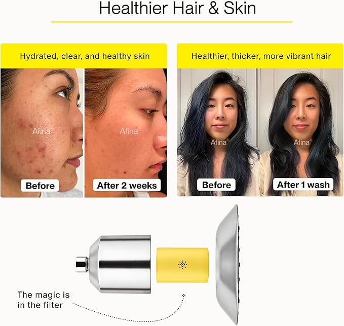 Afina Filtered Shower Head | High Pressure Shower - Reduces Dry Itchy Skin, Dandruff, Eczema, & Dramatically Improves Condition of your Skin, Hair & Nails (Black)