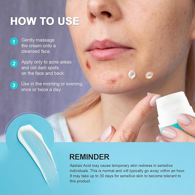 Acne Pimple Spot Treatment Cream: Cystic Hormonal Breakouts Control for Face & Back - 2% Salicylic Acid, Fast Redness Relief, Fades Blemishes & Post-Acne Marks, Teens-Adults, 1.8 oz