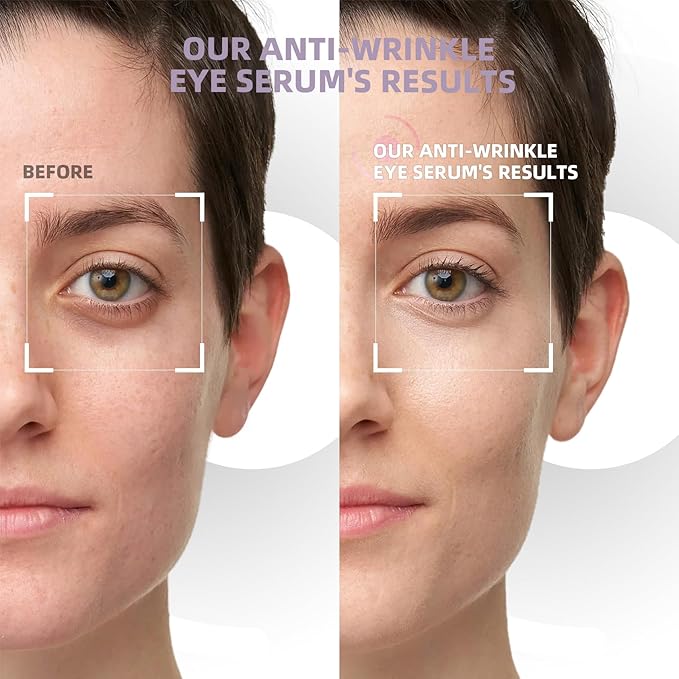 5% Caffeine Eye Cream & Under Eye Serum for Dark Circles and Puffiness Eye Care Eye Roller Serum with 360° Massage Ball Eye Treatment Serum Under Eye Roller Cream for Women Reduce Wrinkles Fine Lines