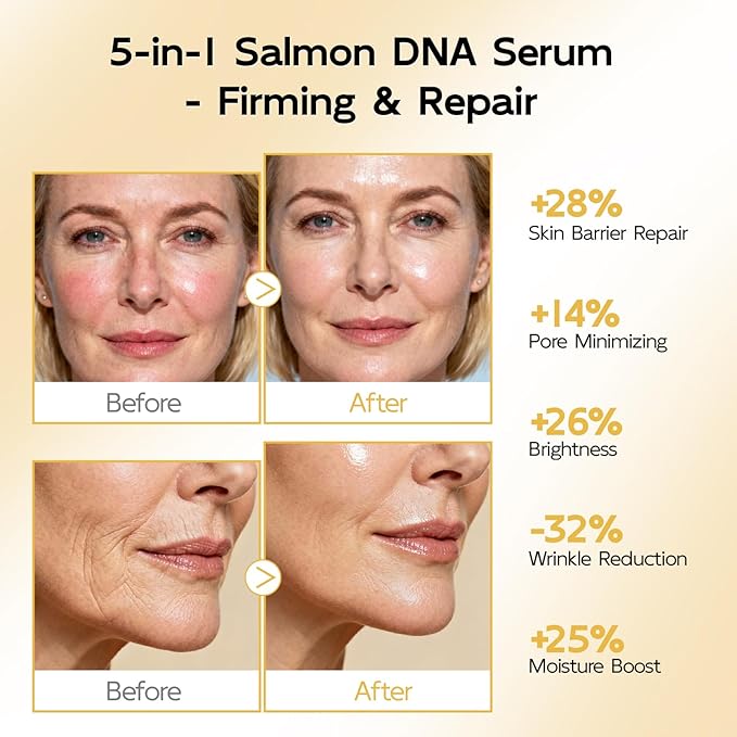 YouthVibe 0.5% PDRN Serum for Face, Anti-Aging Salmon DNA Face Serum with Hyaluronic Acid, Niacinamide & Squalane, Firming & Hydrating for Fine Lines & Wrinkles Skincare - 30ml