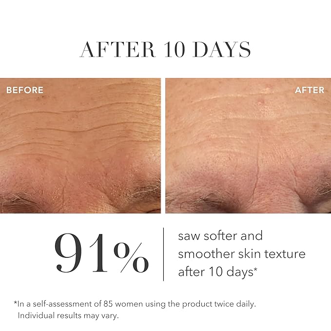 Algenist GENIUS Liquid Collagen Serum - Firming and Hydrating Face Serum with Collagen + Vitamin E - Helps Visibly Minimize Fine Lines + Wrinkles and Improve Elasticity (30ml)