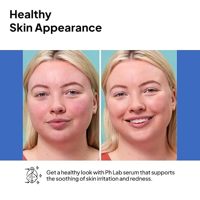 Anti Redness Serum, Reduces Capillary Cracks Appearance, Evens Skin Tone, Skin Soothing and Redness Reform Serum, 1.01 Fl Oz (Pack of 2)