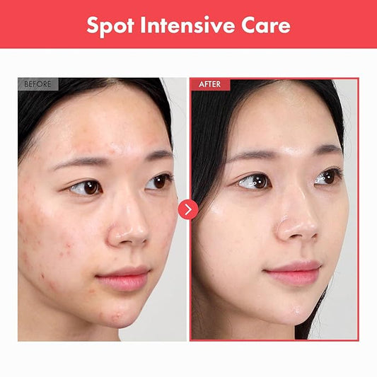 Ovalicin Skin Clear Cream, Skin Soothing, Moisturizing with Niacinamide and Sulfur, Korean Skincare, 50g, 1.76 oz.