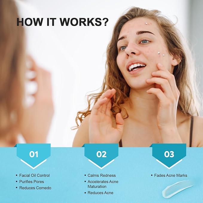 Acne Pimple Spot Treatment Cream: Cystic Hormonal Breakouts Control for Face & Back - 2% Salicylic Acid, Fast Redness Relief, Fades Blemishes & Post-Acne Marks, Teens-Adults, 1.8 oz