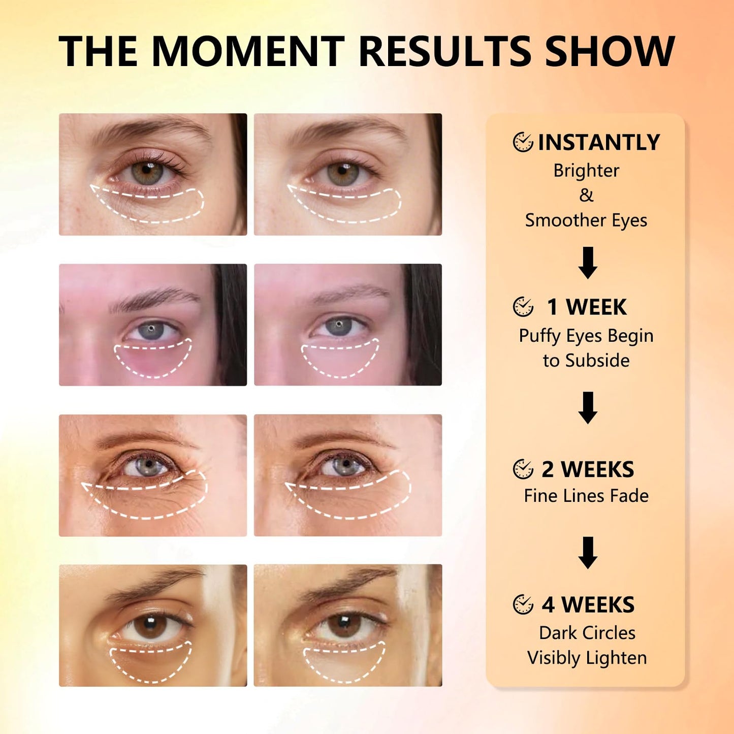 Aeryea Under Eye Patches with Vitamin C & Caffeine 30 Pairs for Dark Circles, Fine Lines and Puffiness, with Niacinamide Hydra-Gel Collagen, Skin Care for Men & Women