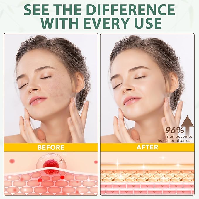 Beef Tallow for Skin, 100% Tallow and Honey Balm, Beef Tallow Moisturizer for Face, Deeply Moisturizing for Face & Body, Unscented Fast Absorption-4.2 Oz