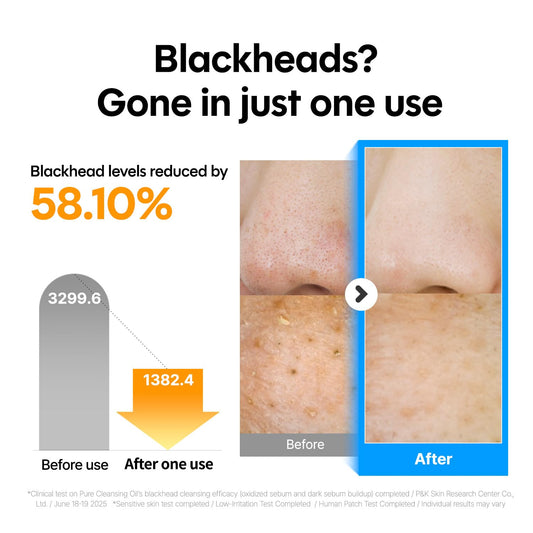 ma:nyo Pure Cleansing Oil, Natural Oil Cleanser for Face, Makeup Blackhead Remover, Korean Skin Care, 6.76 fl oz (200ml)