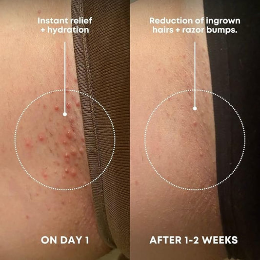 Bushbalm Ingrown Hair Exfoliating Scrub - Reduces Appearance of Ingrown Hairs and Underarm Bumps, Soothes Skin and Post Shave Redness - Nude, 236 ml