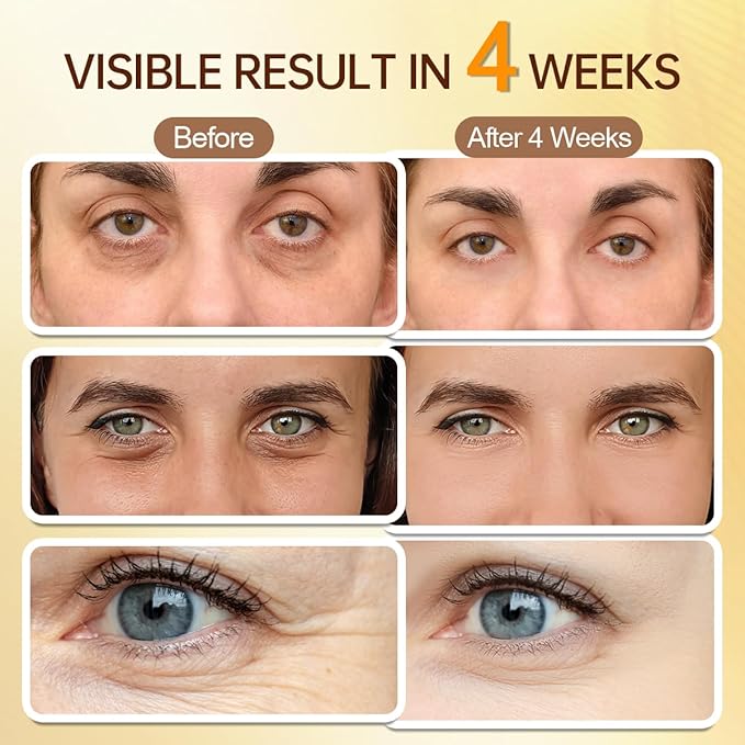 5% Caffeine Eye Serum with Retinal Peptides Hyaluronic Acid for Dark Circles Wrinkles & Eyelid Lift - Instant Morning Bags Depuffing - 360° Roller - Skincare Eye Cream for Women & Men (0.51 fl.oz)