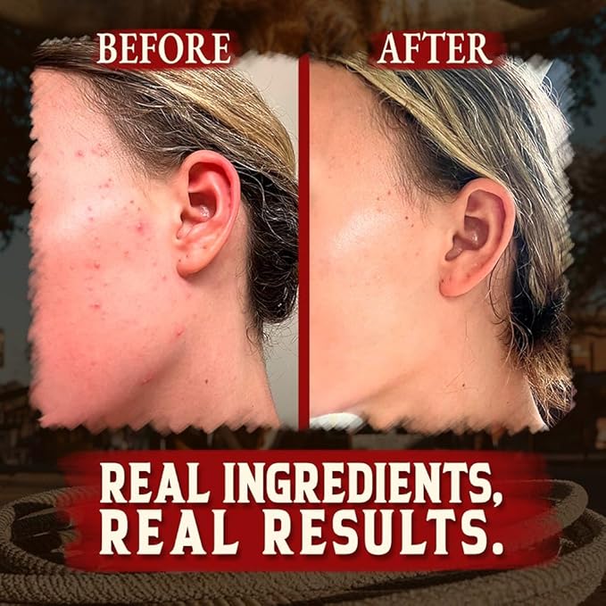 Wrath & Remedy Handmade Whipped Organic Beef Tallow for Skin - 4 OZ (3-Pack) — Grass Fed Beef Tallow Moisturizer and Honey Balm for Silky, Sensitive-Skin, Eczema, Rosacea - Free of Harsh Chemicals