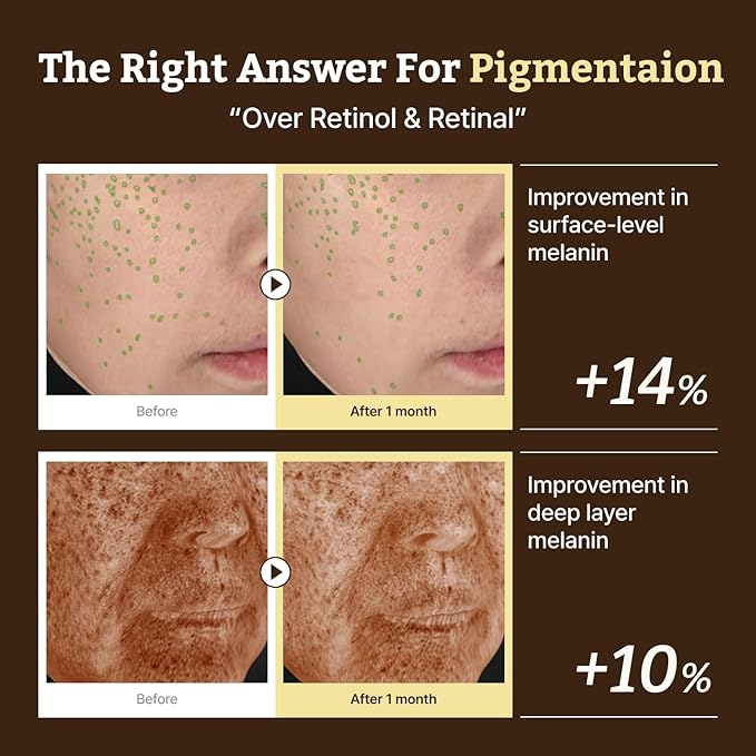 Dr. Reju-All Advanced Retino-Mela Serum – HPR Retinol Serum for Face – Anti-Aging, Pore Minimizer, Next-Gen Korean Skin care – Gentle & Beginner-Friendly – Niacinamide 10% & TXA 4% – 1 Fl Oz