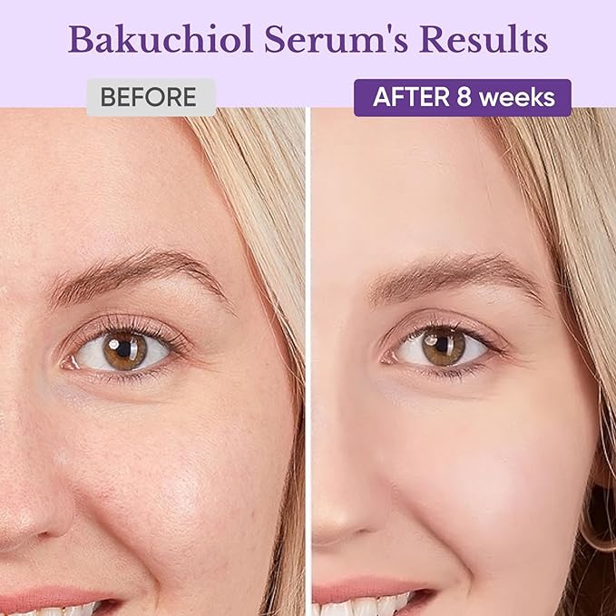 Bakuchiol Retinol Serum for Face, Retinol Alternative for Sensitive Skin with Vitamin E, Hyaluronic Acid, Collagen, Serum for Anti-Aging, Wrinkle Reduction Skin Firming & Smoothing 1 oz