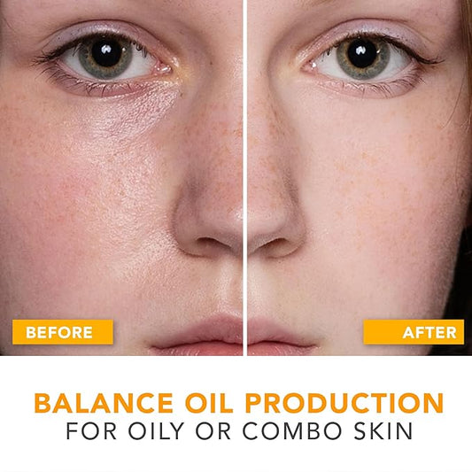 Oil Control Face Moisturizer - USA Made with Natural & Organic Ingredients, Lightweight and Mattifying Moisturizer for Oily & Acne Prone Skin, Face Cream with Niacinamide and Hyaluronic Acid