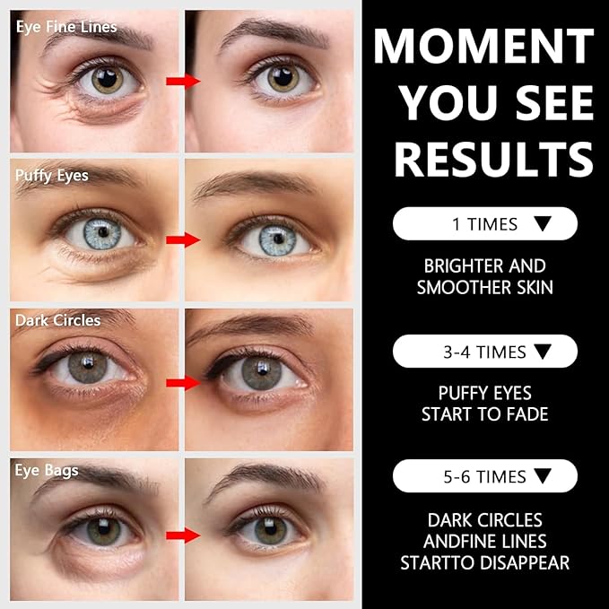 24K Gold Under Eye Patches - 60 Pcs Eye Masks for Dark Circles Puffiness - Skin Care with Collagen Hyaluronic Acid - Anti-Aging & Rejuvenating Hydrogel Eye Patch