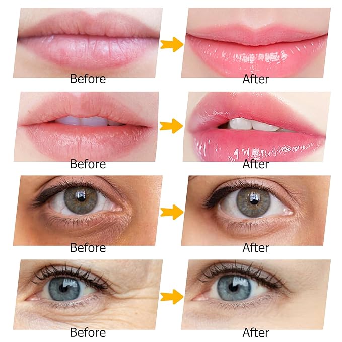 40 Pairs Peach Red Lip Masks & Eye Masks, 24K Gold Gel Collagen Eye Patches for Puffy Eyes, Dark Circles, Wrinkles and Eye Bags, Collagen Crystal Mask Set for Women Men