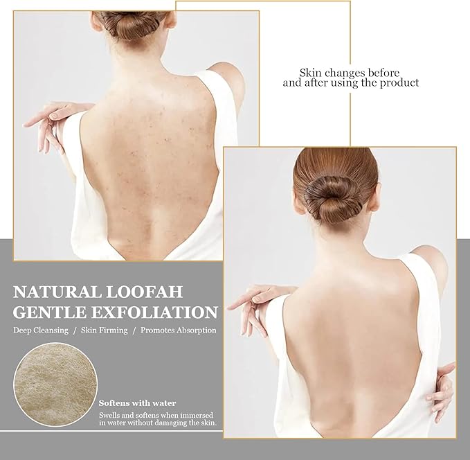 Premium Loofah Bath Set - Exfoliating Back Scrubber with Handle, Shower Gloves & Loofah Pads for Men & Women, Perfect Body Scrubber & Skin Cleanser