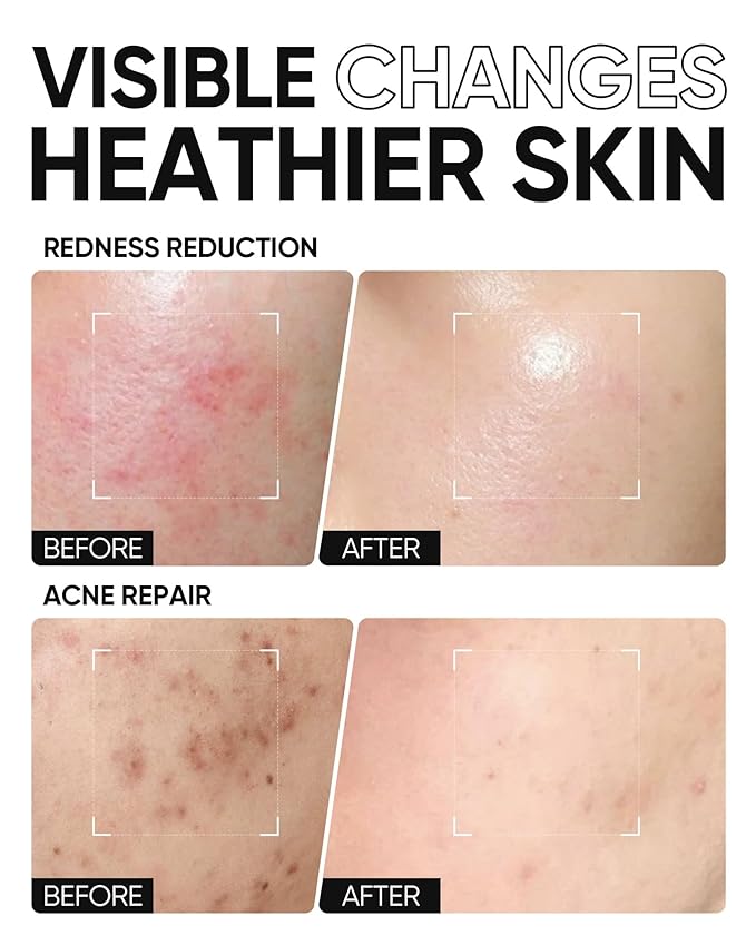 Moisturizing Cream | Face Creams for body care | Facial Creams with Hyaluronic Acid and 5X Ceramides | Hydrating Moisturizer | Fragrance Free Non-Comedogenic | Beauty balm creams