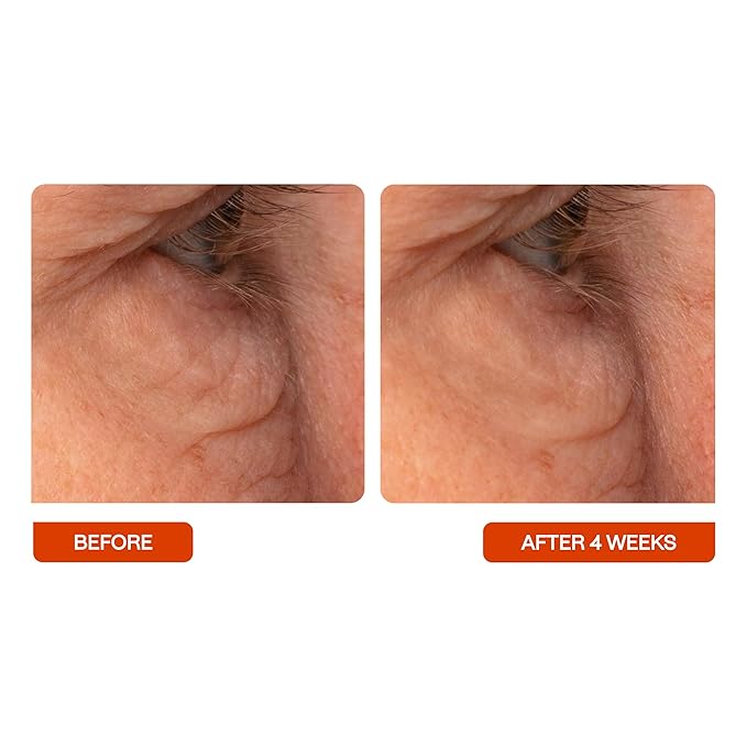 BeautyStat C Eye Perfector Dark Circle Reducing Vitamin C Eye Cream, Made in the USA with 5% L-Ascorbic Acid (Pure Vit C), Hyaluronic Acid - Hydrating, Firming (0.5oz / 15ml)