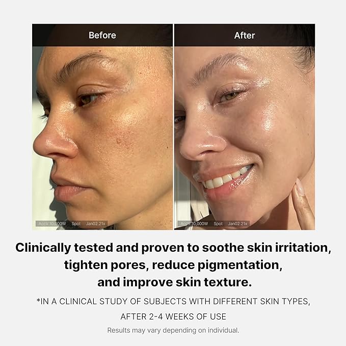 medicube Triple Collagen Cream - Hydrating & Firming Moisturizer with Hyaluronic Acid, Premium Elastin, Shea Butter - Wrinkle Care & Boosts Elasticity - Korean Skincare, 1.69 oz