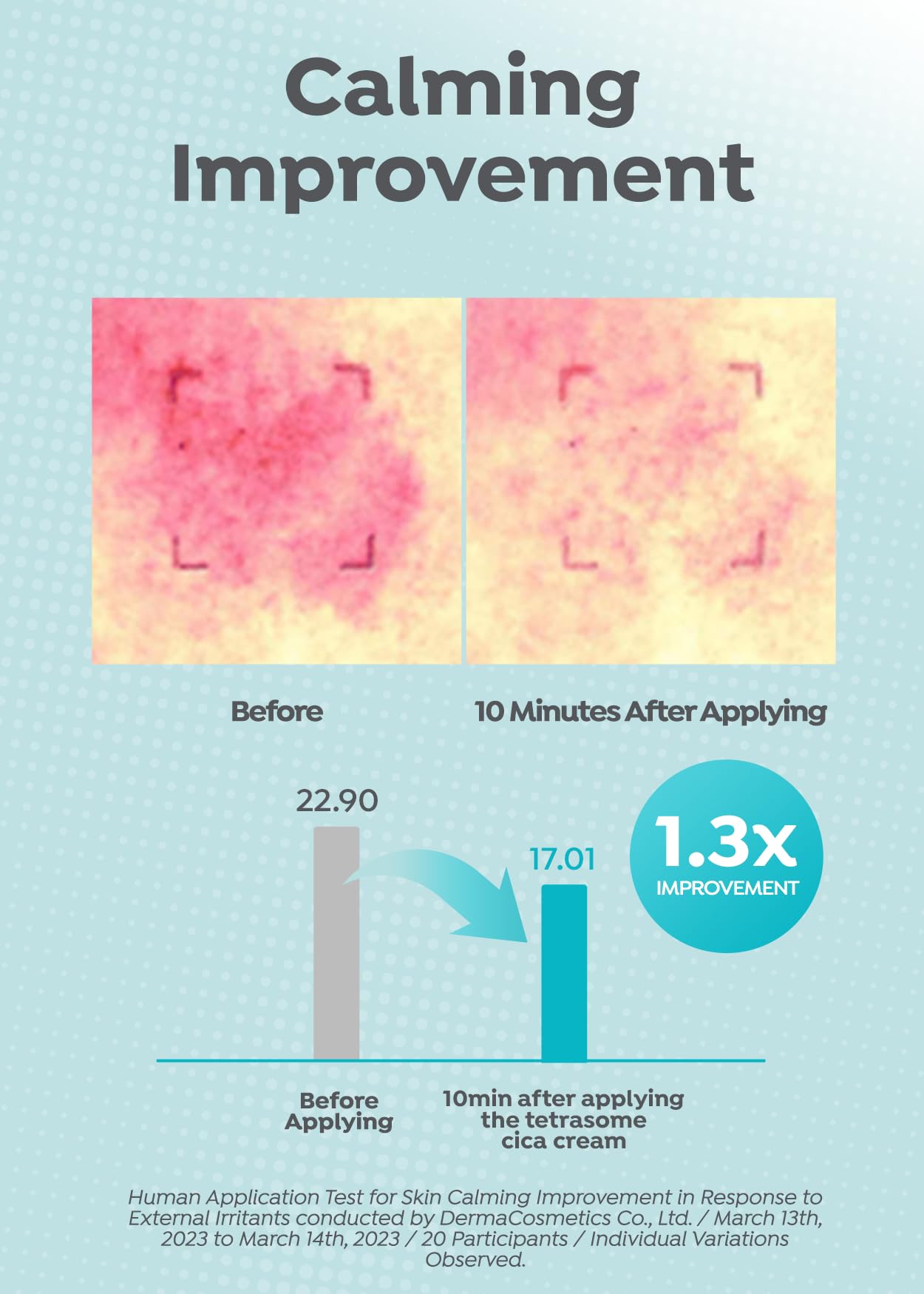 A'PIEU Madecassoside Tetrasome Cica Cream 4.06 Fl oz / 120ml - Upgraded Absorption, Enhanced Skin Barrier, Calming Effects - Centella Asiatica, Asiaticoside, Asiatic Acid