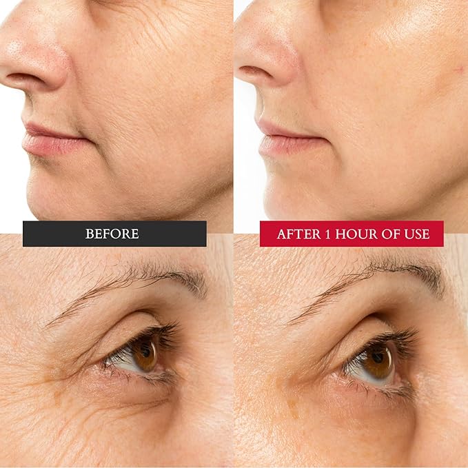 CHUDA Healing Hydrating Cream Skin Care Moisturizer Anti Aging Face Cream - 30ml Made in USA, Daily Moisturizer for Face with Remedea Compound, Healing Cream for Hydrating Moisturizer for Dry Skin