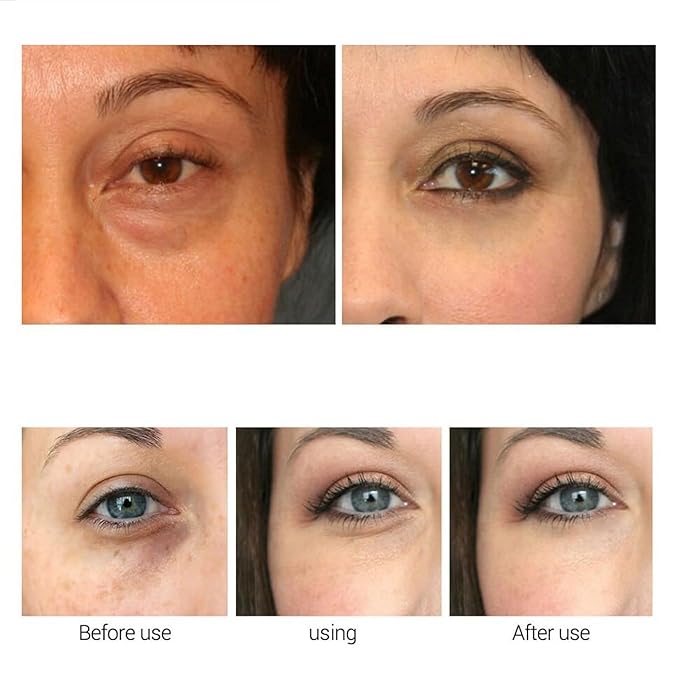 Retinol Caffeine Anti-Wrinkle Stay-Up Late Eye Cream, Retinol Caffeine Anti-Wrinkle Cream, Anti-Aging Eye Cream for Dark Circles & Puffiness (2PC)