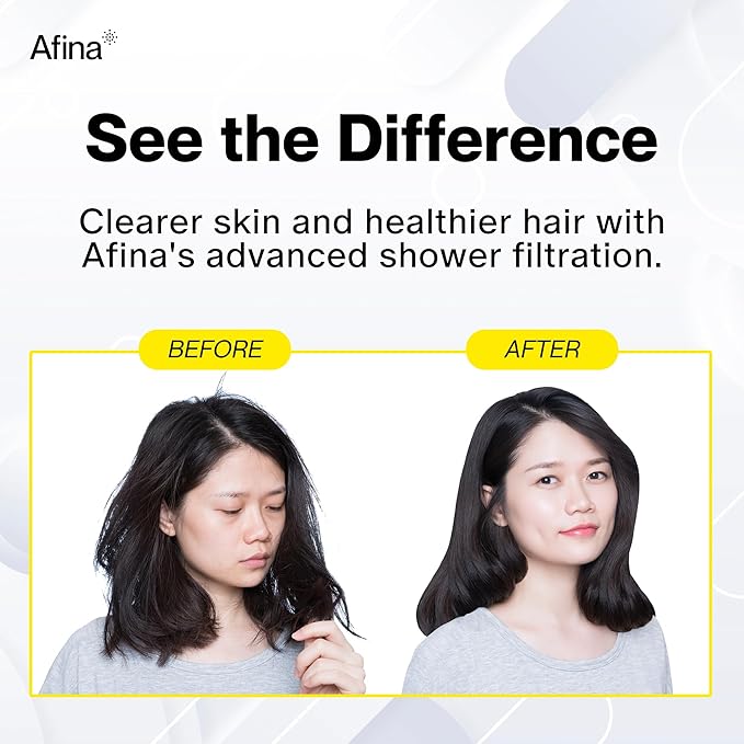Afina Filtered Shower Head | High Pressure Shower - Reduces Dry Itchy Skin, Dandruff, Eczema, & Dramatically Improves Condition of your Skin, Hair & Nails (Chrome)