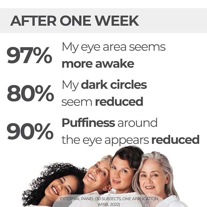 M. Asam MAGIC CARE Perfect Eye Serum - eye serum with 360° tightening effect, effectively fights puffiness & dark circles, tightens the eyelid, eye care with hyaluronic acid complex, 0.84 Fl Oz