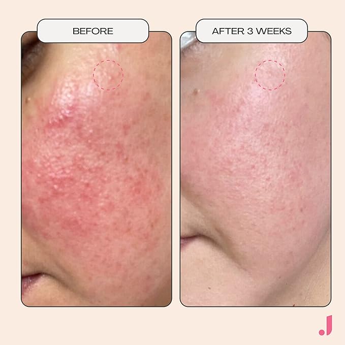 JESS BEAUTY | Face Moisturizer Gel Mask Post Workout with Niacinamide & Centella Asiatica | Skin Care Revitalizing 1.7 fl oz