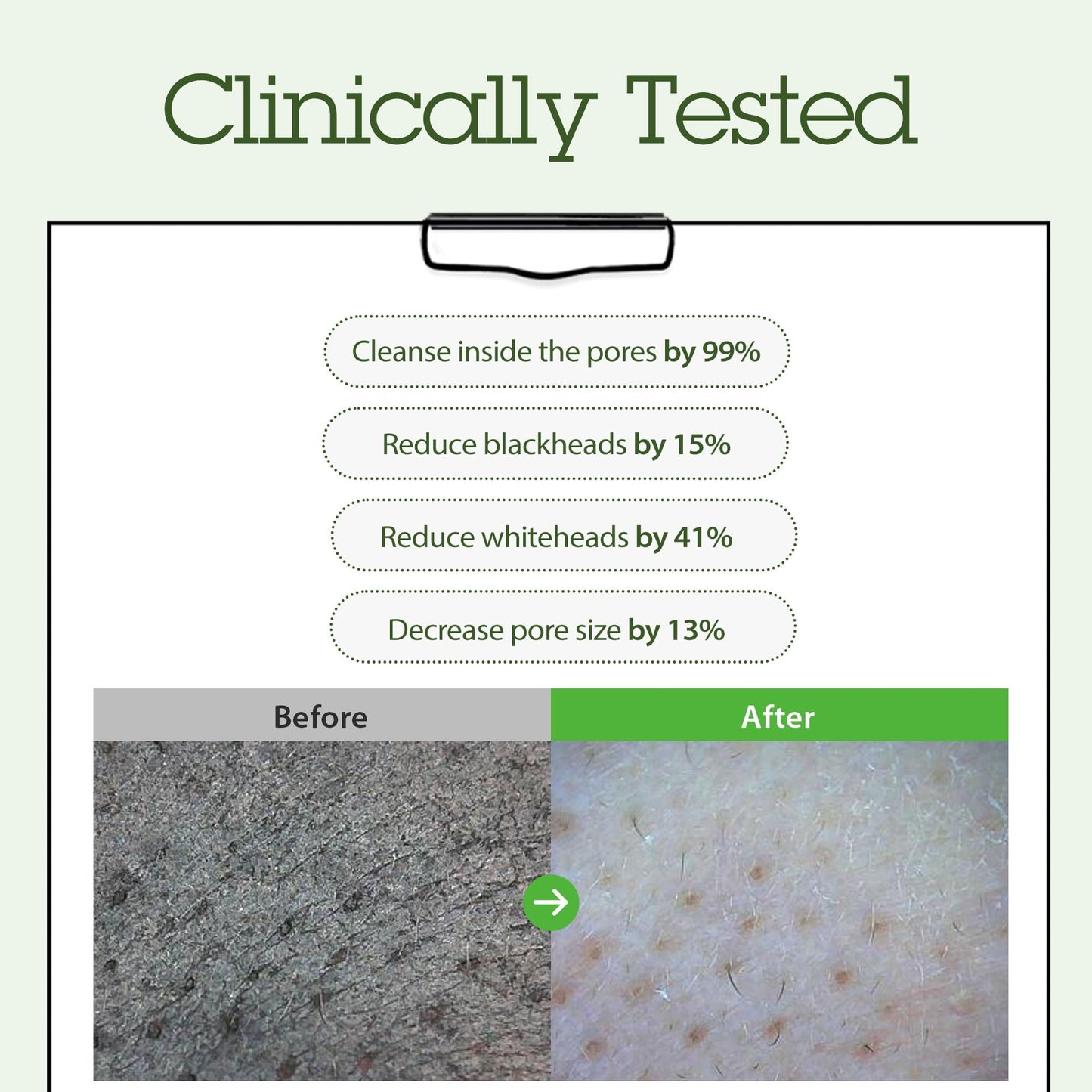 BLITHE Cleansing Balm, Pore Cleansing Makeup Remover Balm, Hygenic Design, Korean Makeup Remover