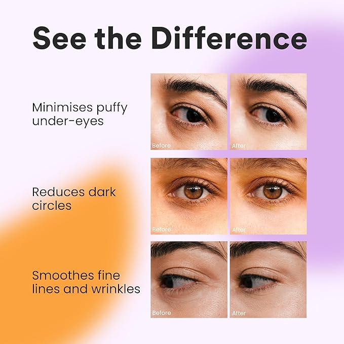 BLAQ Kakadu Plumpers Premium Under Eye Patches for Dark Circles and Puffiness. Australian Native Plum Extracts, Vegan and Cruelty-Free, 5-Pack