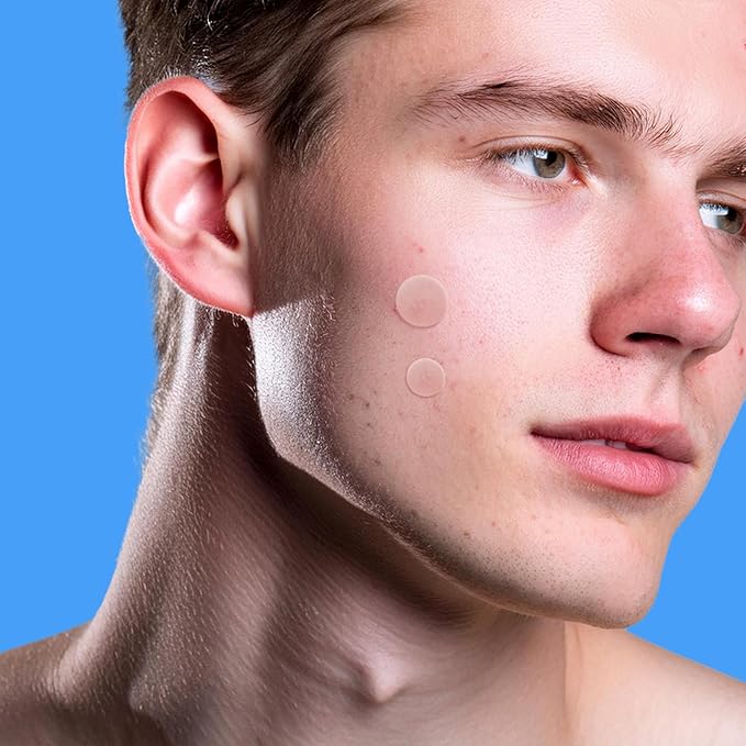 AVARELLE Pimple Patches for Face | Hydrocolloid Acne Patches for Covering Blemishes | FSA HSA Zit Patches with Tea Tree, Calendula, & Cica | HSA Store Eligible Items (10-14 mm, 80 Count)