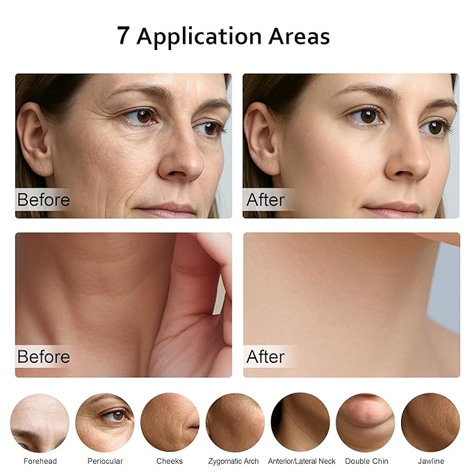 7 in 1 Multifunctional Facial Massager, Red Light Therapy for Face, Beauty Skin Care Tool for Face and Neck, Portable Facial Massager for Wrinkles and Skin Care-White