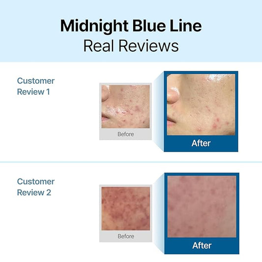 DearKlairs Midnight Blue Calming Cream – Soothing Face Moisturizer for Oily & Sensitive Skin, Redness Relief & Hydrating, Lightweight Texture, 1.01 Fl Oz