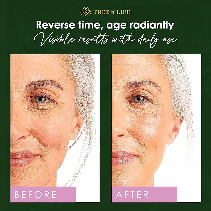 Tree of Life Beauty Retinol Serum, Skin Smoothing Face Oil for Dark and Age Spots and Fine Lines, Facial Serums for Dry and Sensitive Skin Care with Hyaluronic Acid for Soft Skin, 2 Fl Oz (pack of 2)