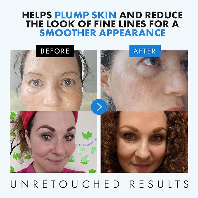 Eclat Skincare Hydrating Hyaluronic Acid Serum for Face – 2.5% Hyaluronic Acid + 3% B5, Green Tea & Jojoba Oil - Moisturizing & Plumping Formula for Smoother Skin - Stocking Stuffers for Women 1 Fl Oz