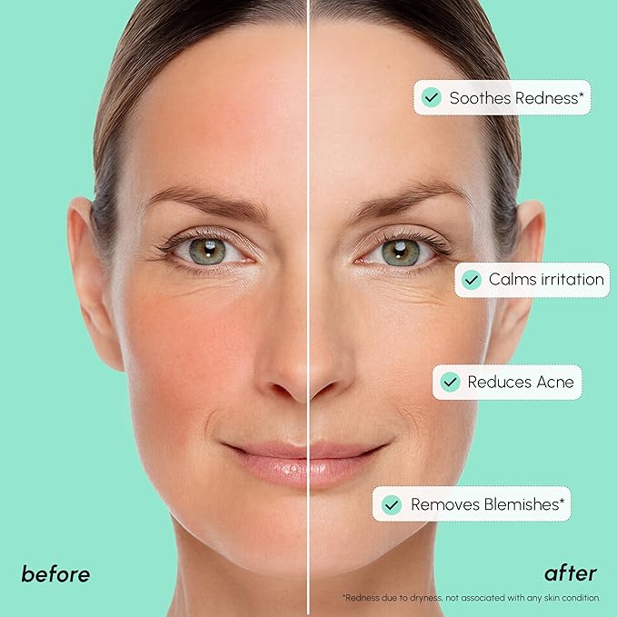 MAREE 10% Azelaic Acid Face Serum - Redness Soothing Hydrating Serum with Niacinamide, Centella Asiatica & Hyaluronic Acid - Relief Serums for Face & Body - Azalecic Acid Skin Facial - Acido Azelaico