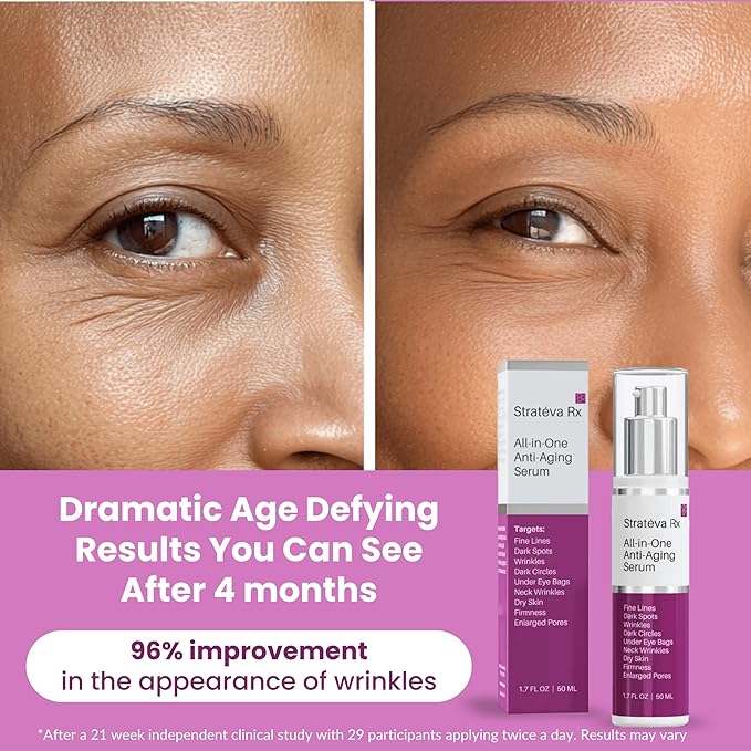 LeVaye Strateva RX Advanced Anti-Aging Serum – Vitamin C, Niacinamide, Natural Retinol, Hyaluronic Acid & Peptides – Targets Wrinkles, Fine Lines, Dark Spots, Dark Circles & Enlarged Pores