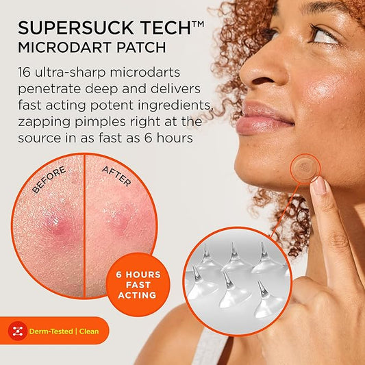 ZitSticka Killa Mini Acne Patches for Face - World's Most Potent Pimple Patch with Fast-Acting Microdarts - Starts Working within 2 Hours for Deep, Early-Stage Zits - 8 Count