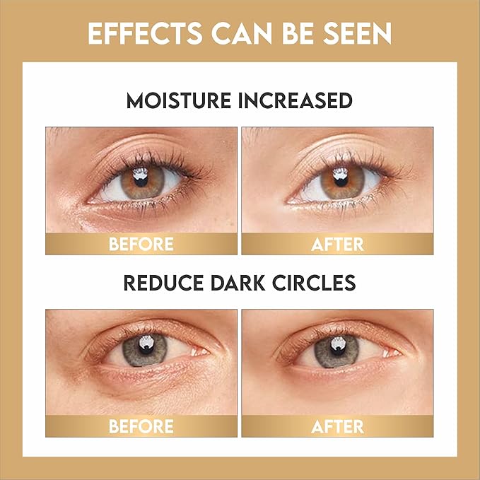 25 Pairs 24K Gold Under Eye Mask/Patches For Moisturizing, Dark Circle Treatment, Wrinkles, Puffy Eyes, Gift For Birthdays, Wedding, Daily Use, Parties, Unisex Under Eye Mask