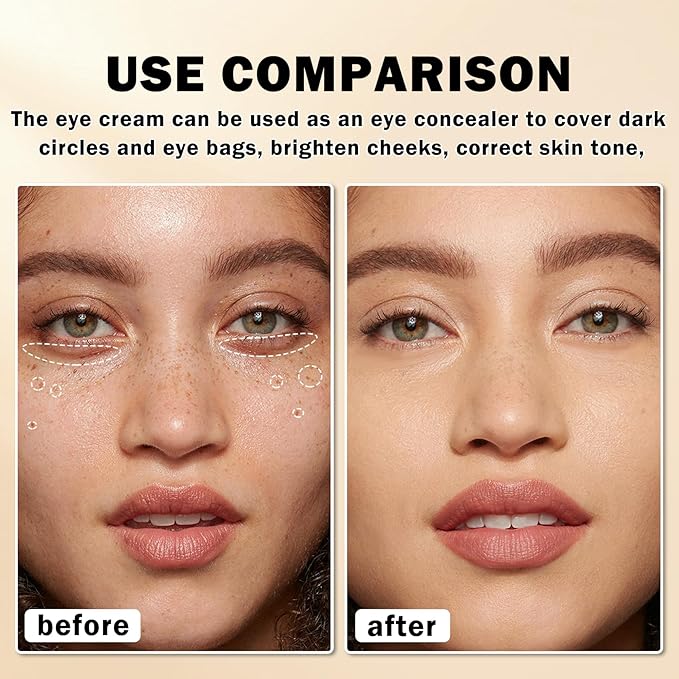 Mineral Sunscreen Eye Cream for Dark Circles,3-in-1 Under Eye Cream Anti Aging for Puffiness and Bags Under Eyes,Under Eye Corrector SPF 35（Medium）