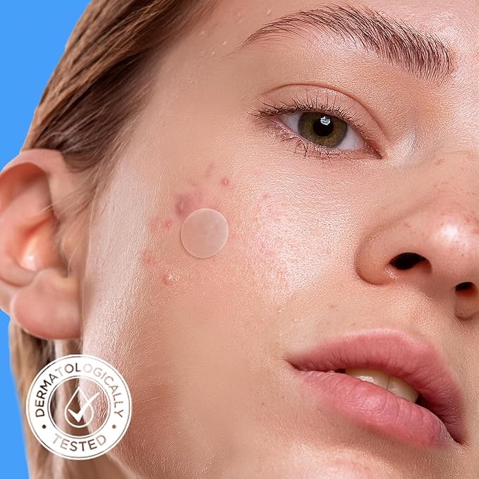 AVARELLE Pimple Patches for Face | Hydrocolloid Acne Patches for Covering Blemishes | FSA HSA Zit Patches with Tea Tree, Calendula, & Cica | HSA Store Eligible Items (10-14 mm, 200, Count)