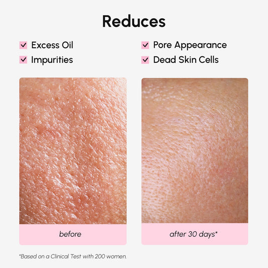 MAREE Pore Minimizer for Face Toner – Witch Hazel Toner with Niacinamide & Marine Collagen – Gentle Exfoliating Oil Control Facial Toner for Women – BHA Liquid Exfoliant – Alcohol Free Tonico Facial