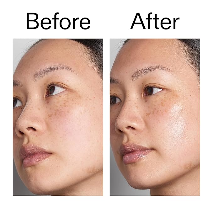 The INKEY List Hyaluronic Acid Serum - Delivers Instant and Lasting Deep Hydration, Plumps Dry Skin, Vegan & Suitable For All Skin Types