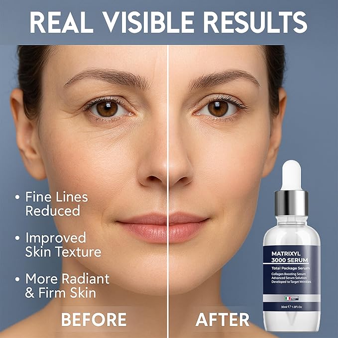 Matrixyl 3000 Total Package Serum with Hyaluronic Acid, Argireline Serum for Anti-Wrinkle, Collagen Boosting, Anti-Aging & face hydrating, Deep Wrinkle Repair & Firming for Fine - 30ml